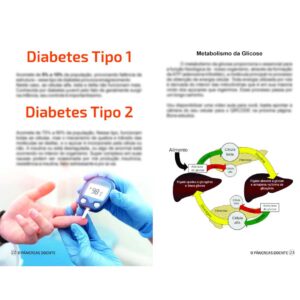Livro O Pâncreas Doente Diabetes Tipo 1 E Tipo 2 Tiago Rocha